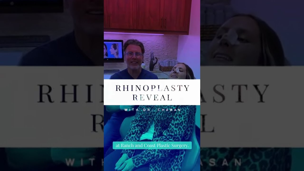 Rhinoplasty Reveal - #14