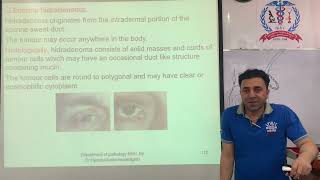 Tumours of sweat glands ( ecrine poroma, ecrine hidradenoma)pashto.