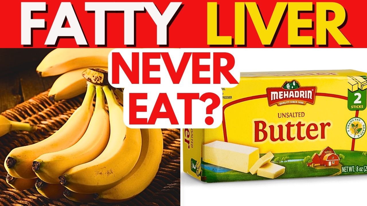 9 AWFUL foods for Fatty Liver (+10 great Liver-Friendly alternatives)