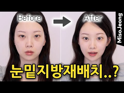 눈 밑 지방 재배치 고민돼 ? 다크서클? 나이 들어 보인다면, 이 루틴 먼저 해봐🔥 [+이벤트🎁]