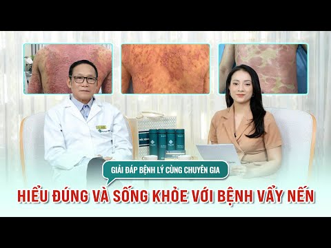 VẨY NẾN: Hiểu Đúng & Sống Khỏe với bệnh | Giải đáp bệnh lý cùng PGS.TS Đặng Văn Em
