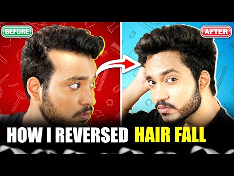 HAIR FALL KO STOP KARO DAY 1 SE ( SCIENCE BASED ) | HOW I REVERSED MY HAIR FALL