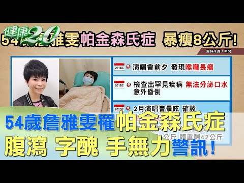 54歲詹雅雯罹帕金森氏症 瘦到剩42公斤！ 健康2.0