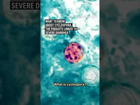 What to know about cyclospora, the parasite linked to severe diarrhea