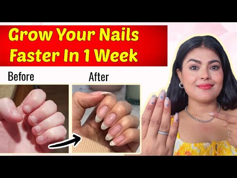 Natural Secret Of My Long Nails 🤫 ~ Grow Your Nails 💅Faster In 1 Week 🎀|| Just 1 Step