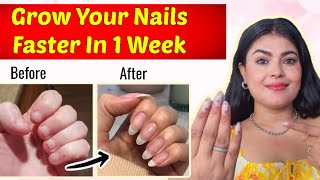 Natural Secret Of My Long Nails 🤫 ~ Grow Your Nails 💅Faster In 1 Week 🎀|| Just 1 Step