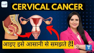 Top NCLEX RN Question Topic: Cervical Cancer | All You Need to Know! (Hindi, Urdu, Punjabi)