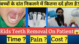 बच्चों के दांत निकालने में कितना दर्द होता है |डॉ.दिशा के साथ जानिए! |Kids Teeth Removal |Baby Teeth