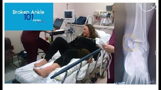 The first 24 hours - Broken Ankle 101 Series - hospital, Xrays, crutches