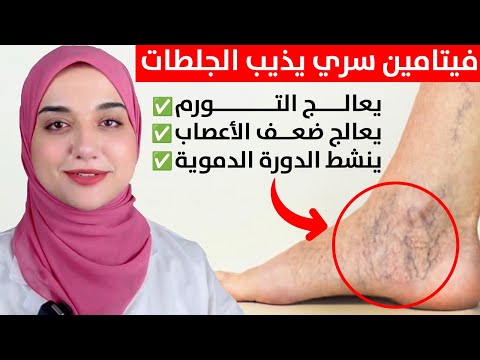 فيتامين سحرى يقوى الساقين/ يعالج التهابات الاعصاب و الدوالى و يمنع الجلطات وتشنجات العضلات