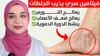 فيتامين سحرى يقوى الساقين/ يعالج التهابات الاعصاب و الدوالى و يمنع الجلطات وتشنجات العضلات
