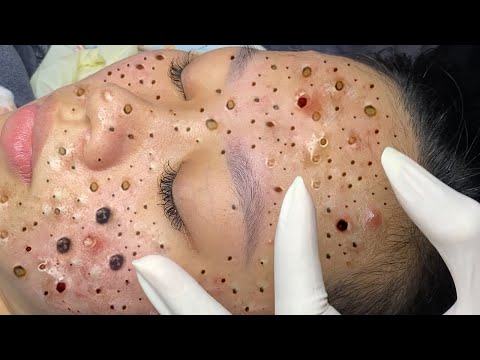 Enjoy your lucky day with loan nguyen spa #240