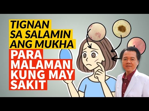 Tingnan sa Salamin ang Mukha, Para Malaman Kung May Sakit o Wala.  (Repost Video)