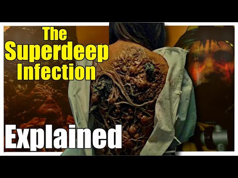 The SuperDeep FUNGAL INFECTION Explained | Why are we driven to dig really deep holes in the planet?