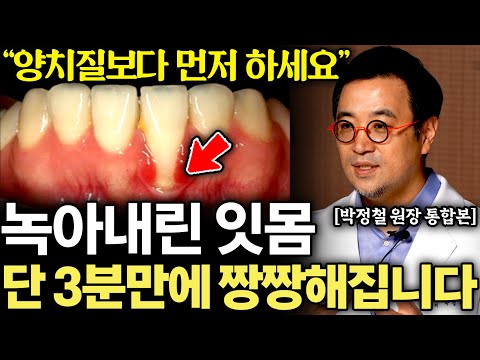 "치실,가글 아닙니다" 양치질 보다 먼저 하면 잇몸병 싹 사라지고 잇몸도 탄탄해집니다. (박정철 원장 통합본)