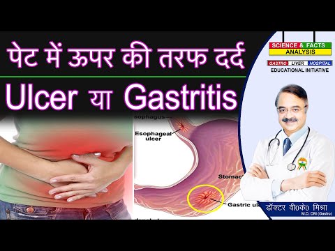 पेट में ऊपर की तरफ  दर्द अल्सर या गैस्ट्रिटिस || ORGANS INSIDE ABDOMEN Part 2
