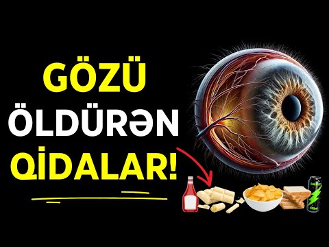 Bu Qidalar Gözlərinizi Məhv Edir! 99% İnsan Bunun Fərqində Deyil!