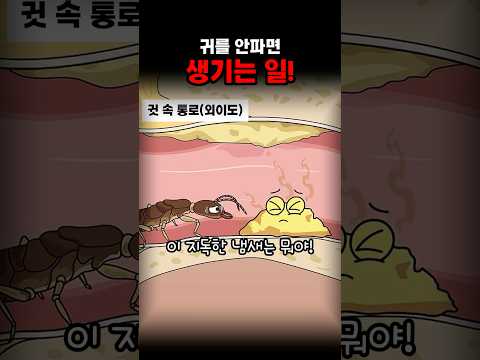 귀를 안파면 생기는 일!