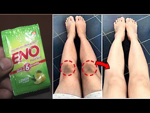 5 मिनिट - Dark Elbows, Knees or Neck के कालेपन से छुटकारा पाए | Whiten Dark Elbows, Knees with Eno