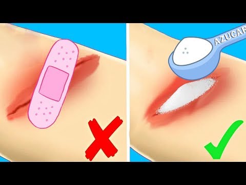 5 Trucos Que Te Salvaran La Vida