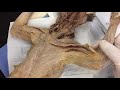 Dissection Techniques and Best Practices