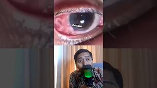 HOROR‼️ CACING yang hidup di dalam MATA 😱 #faktakesehatan #faktaunik #drbimo #edukasi