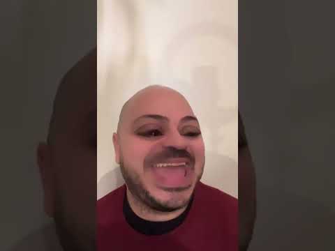 IMBARAZZI - IL CODINO