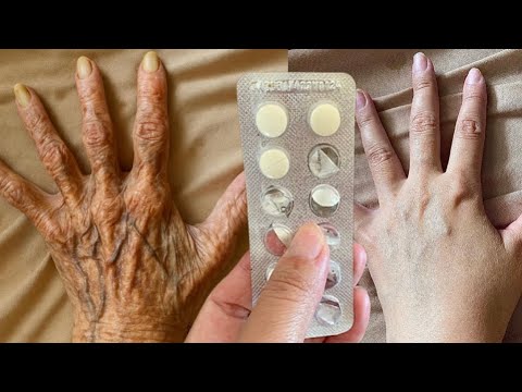 ESMAGA 1 E ESFREGA NAS MANCHAS PRETAS E BRANCAS- ATÉ AS RUGAS DOS DEDOS SOMEM…