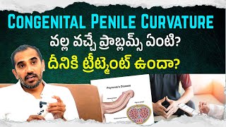 What Are The Congenital Penile Curvature Problems & Solution  Dr Kranth Kumar Reddy Jai Andrology