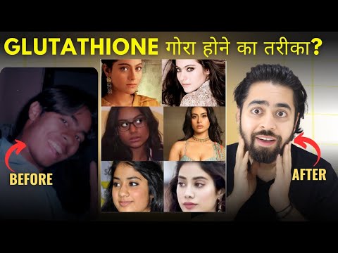 Glutathione kya hota hai | What is Glutathione | Skin Whitening and Lightening Treatments