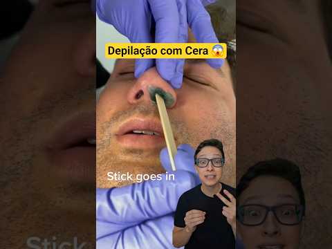 Depilação de Nariz 😱#medicina #medico #enfermagem #enfermeiro #enfermeira Pelos da Narina com Cera