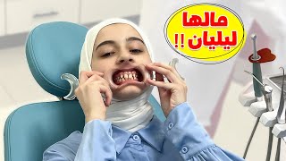 وأخيراً ليليان ركبت تقويم لأسنانها 😬 شوفوا النتيجة كيف صارت