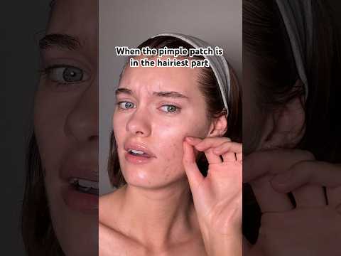 Who can relate?🥲#acne #pimplepatch #acnetreatment #skincareproducts