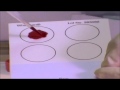 Dried Blood Spot Procedures and Safety