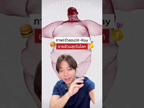 X-ray ชายที่อ้วนสุดในโลก⁉️ #อ้วน #ที่สุดในโลก #xray #ความรู้ #การแพทย์ #สุขภาพ