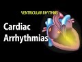 Exploring Cardiac Arrhythmias and ECG Interpretation