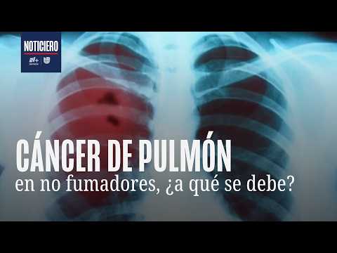 Doctores descubren que el cáncer de pulmón en no fumadores va en aumento y afecta más a mujeres