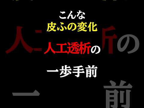 【知らないと危険】こんな「皮ふの変化」腎臓が悪いサイン#医師#人工透析#予防医学チャンネル