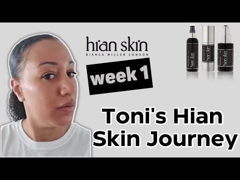 Toni's Hian Skin Journey Week One: Starting To See Change - Hian Skin - Bianca Miller London