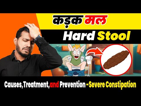 कड़क मल-Hard Stool: Causes,Treatment,and Prevention -Severe Constipation (Vibandha) treatment|Ep.532