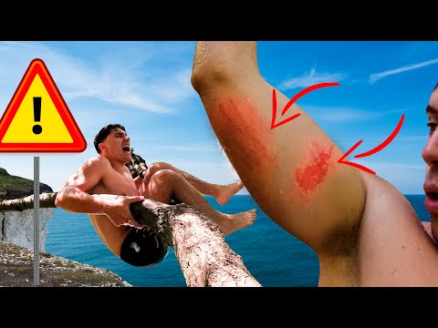 OZLJEDIO RUKU ZBOG SKOKOVA U VODU! ft@MarkoKC96