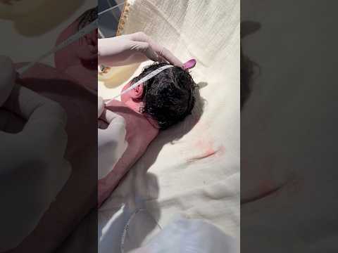 Measure the length of the baby #shorts