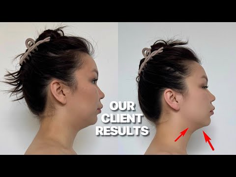 [11-MIN] BEAUTIFUL LIFTING Massage for Every Day