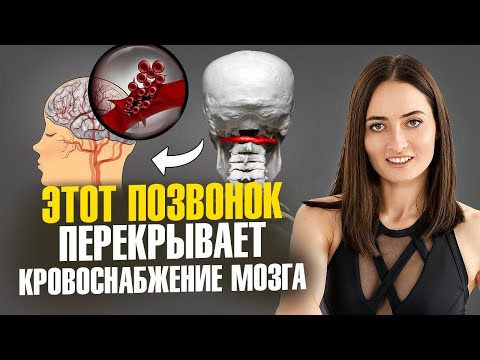 Нарушение кровоснабжения мозга, боли в шее, риск инсульта, высокое давление и всё из-за ЭТОГО