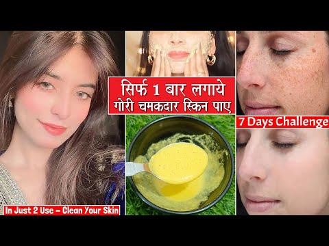 1 बार लगाने से ही दिखेगा फर्क - स्किन की सारी प्रॉब्लम खत्म होकर, बेदाग गोरी Glowing होगी| skincare