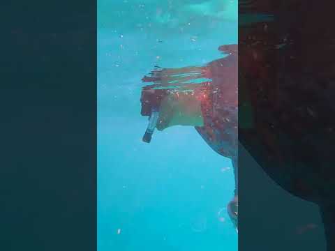 Jellyfish stung me on the face!