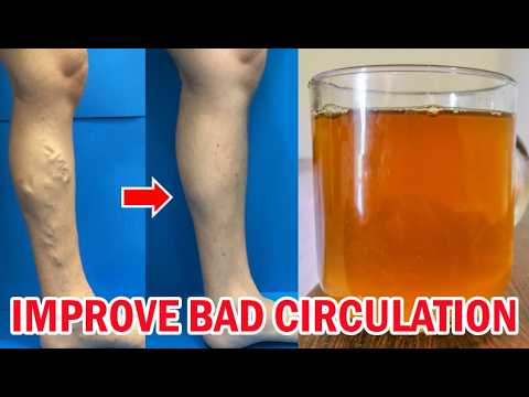 The ONLY Tea You NEED to Improve Leg Circulation!