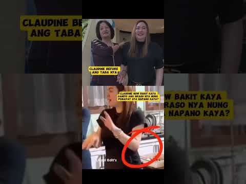 ano kayang nangyare sa braso nya parang bumaloktot nung pumayat sya