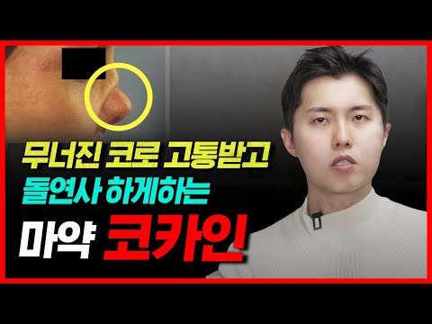 코카인에 중독되면 얼마나 끔찍하게 죽게 될까? | 코카인이 악마의 저주인 이유