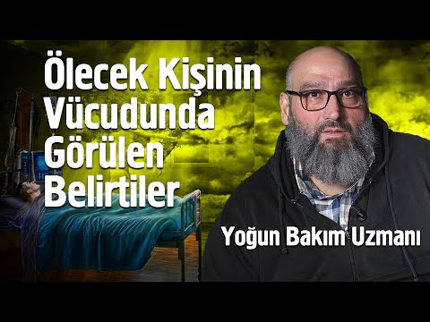 Ölecek Kişinin Vücudunda Görülen Belirtiler - Yoğun Bakım Uzmanı
